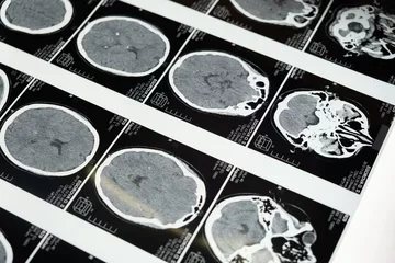 Brain imaging scans.