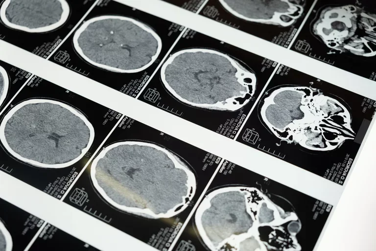 Brain imaging scans.