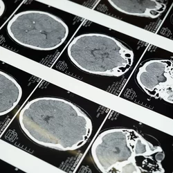 Brain imaging scans.